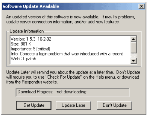 grey box with option to update respondus