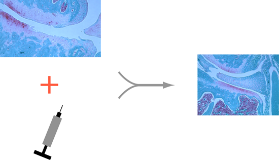 deteriorated cartilage plus drug delivery results